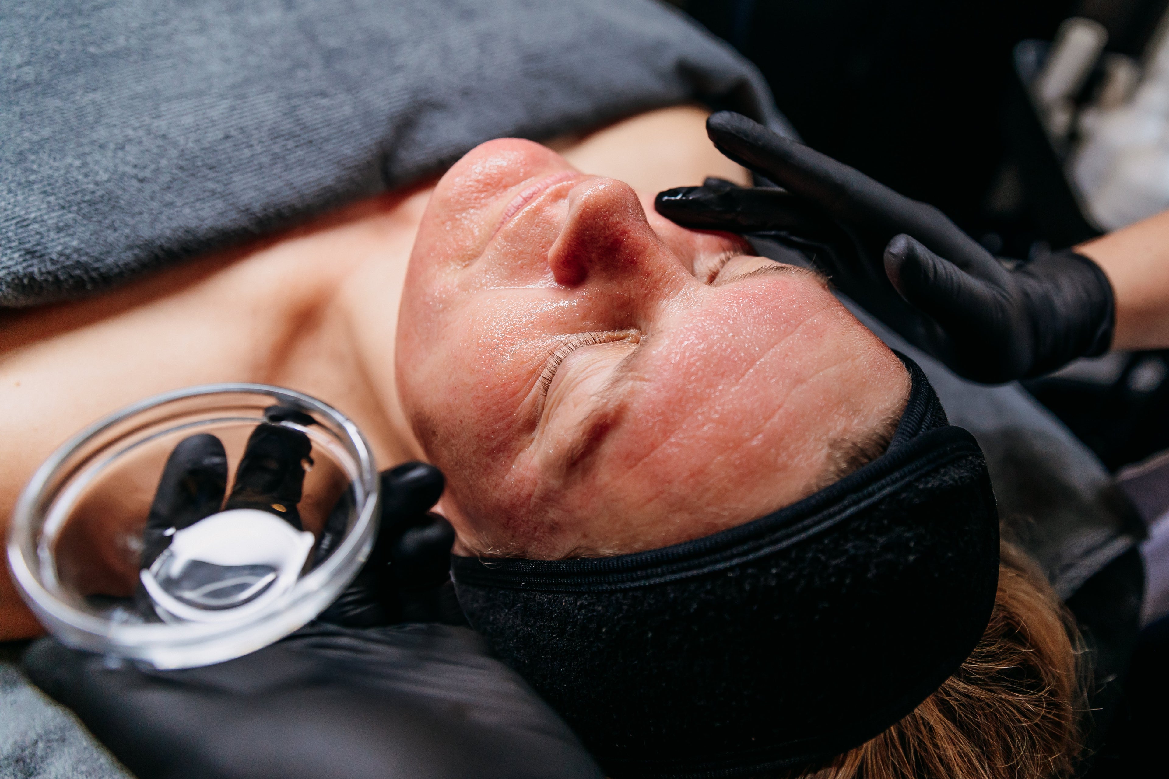 Glow dit najaar met Cupping en Peeling.